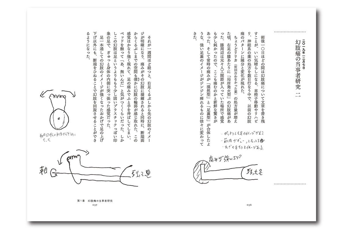 『幻肢痛日記』P36～P37より